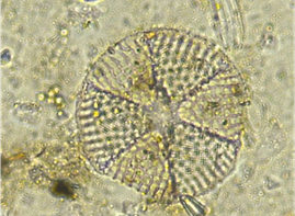 Mississippi diatom Actinoptychus senarius.